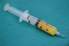 Penis büyütme ameliyatı için yağ dokusu içeren şırınga